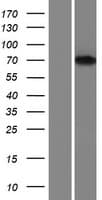 FNBP1 / FBP17 Protein (Over-Expression Lysate Myc-DDK (Flag))