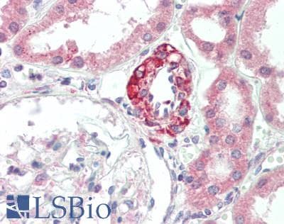 IHC-plus™ IL17RB Antibody