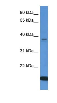 WDR54 Antibody (aa245-294)