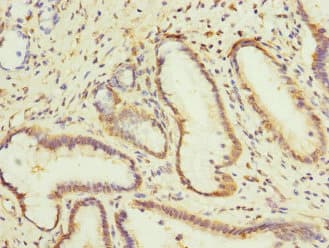 CPD Antibody