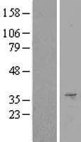 SURF1 Protein (Over-Expression Lysate Myc-DDK (Flag))