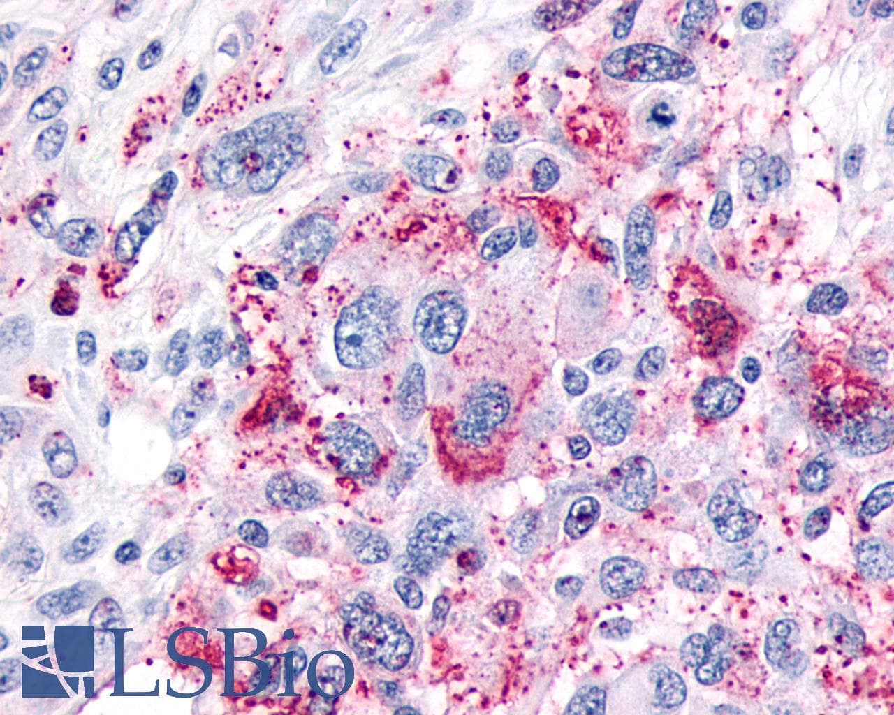 PathPlus™ Polyclonal Rabbit anti-Human MRGPRX3 / MRGX3 Antibody (Extracellular Domain, IHC)