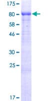Human ISM2 Protein (Recombinant GST)