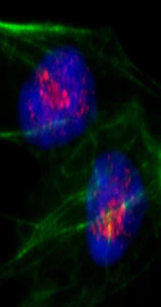CD3EAP Antibody (aa404-454)
