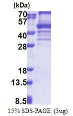 Human EBNA1BP2 Protein (Recombinant His)