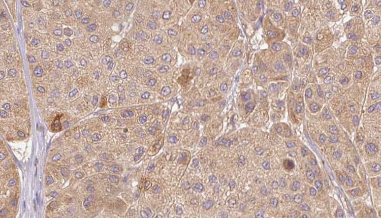 CTGF Antibody