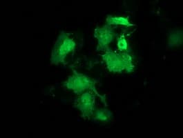 HSPB8 / H11 / HSP22 Antibody (clone OTI1E3)