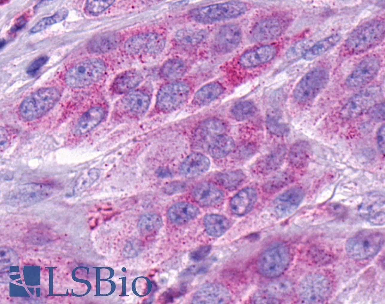 IHC-plus™ Polyclonal Rabbit anti-Human SMO / Smoothened Antibody (1st Extracellular Domain, IHC, IF)