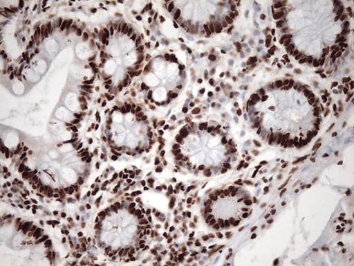Monoclonal Mouse anti-Human TRIM28 / KAP1 Antibody (clone OTI7A4, Carrier-free, IHC, IF, WB)