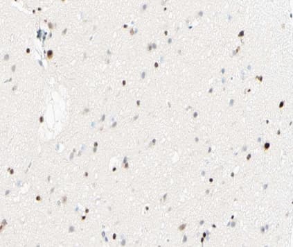 Polyclonal Rabbit anti-Human NFKB1 / NF-Kappa-B Antibody (phospho-Ser893, IHC, IF, WB)