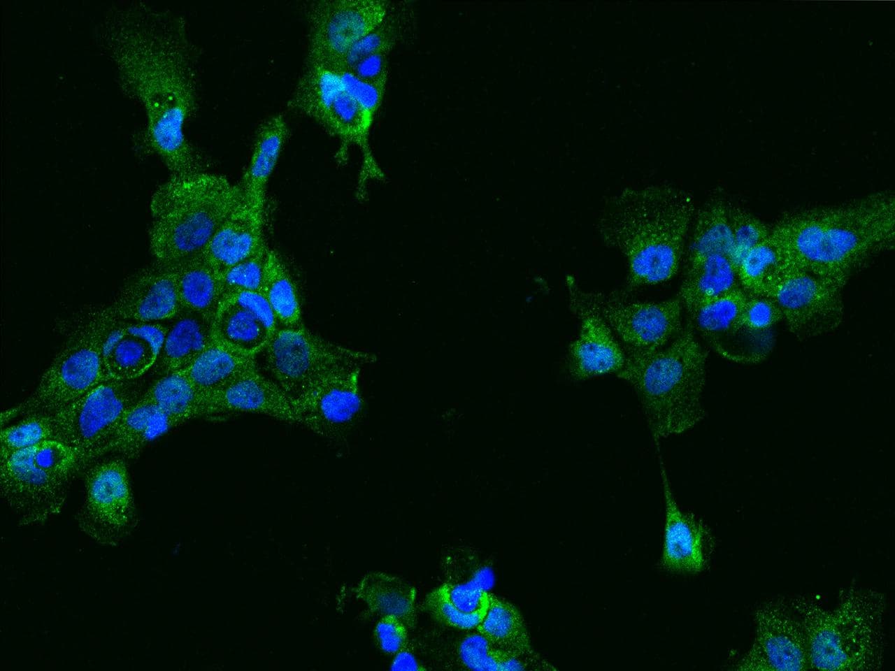 ACY3 Antibody