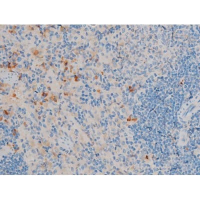 CREB1 / CREB Antibody (phospho-Ser142)