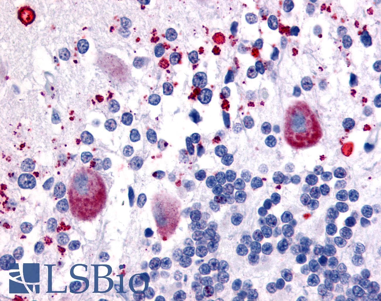 IHC-plus™ Polyclonal Rabbit anti-Human HTR7 / 5HT7 Receptor Antibody (C-Terminus, IHC)
