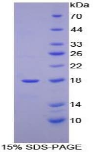Human HBM Protein (Recombinant His-T7)