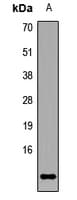 PCNA-Associated Factor Antibody