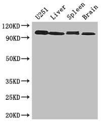 Polyclonal Rabbit anti-Human MAP10 / KIAA1383 Antibody