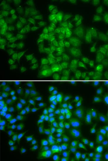 Polyclonal Rabbit anti-Human LMO4 Antibody (IF, WB)