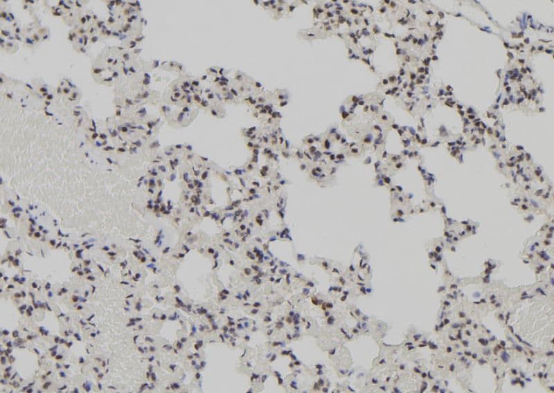 AEBP2 Antibody
