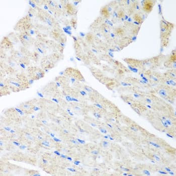 GABARAPL2 / ATG8 Antibody (AP)