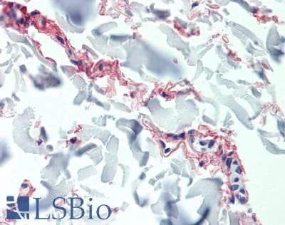 IHC-plus™ Polyclonal Rabbit anti-Human EMILIN1 / EMI Antibody (IHC)
