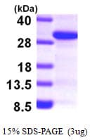 Human SCAND1 Protein (Recombinant His)