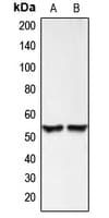 BMP3 Antibody (Internal)