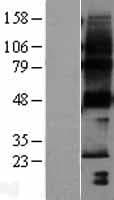 HACD1 / PTPLA Protein (Over-Expression Lysate Myc-DDK (Flag))
