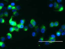 Monoclonal Mouse anti-Human EMA / MUC1 Antibody (clone OTI4A5, IHC, IF, WB)