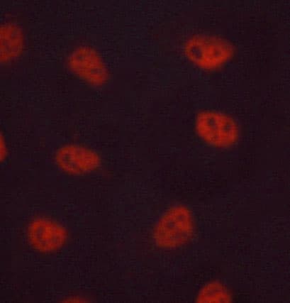 Polyclonal Rabbit anti-Human FOSB Antibody (IF, WB)