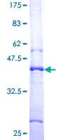 Human Spinal Musculuar Atropy Sma4 Protein (Recombinant GST)