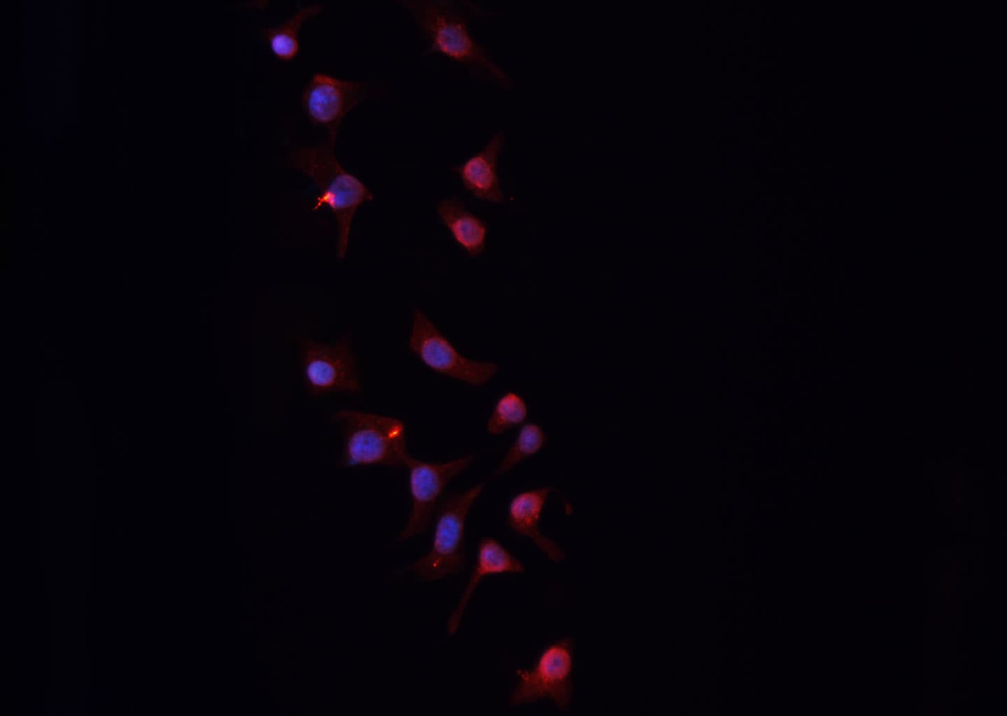PGF / PLGF Antibody