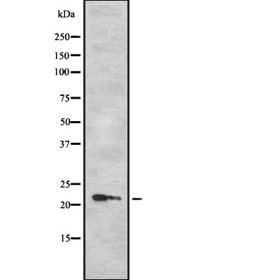TPD52L1 Antibody