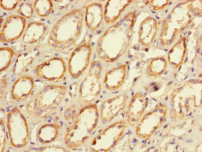 CLEC18A Antibody