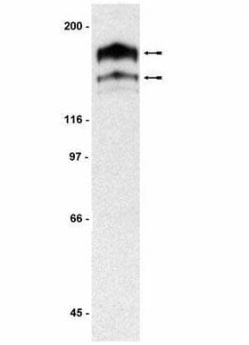 PathPlus™ PDGFRA / PDGFR Alpha Antibody (aa1000-C-term)