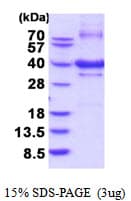 Human NBP / NUBP1 Protein (Recombinant His)