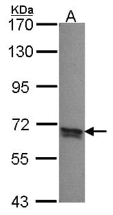 PPP2R5B Antibody (aa434-497)