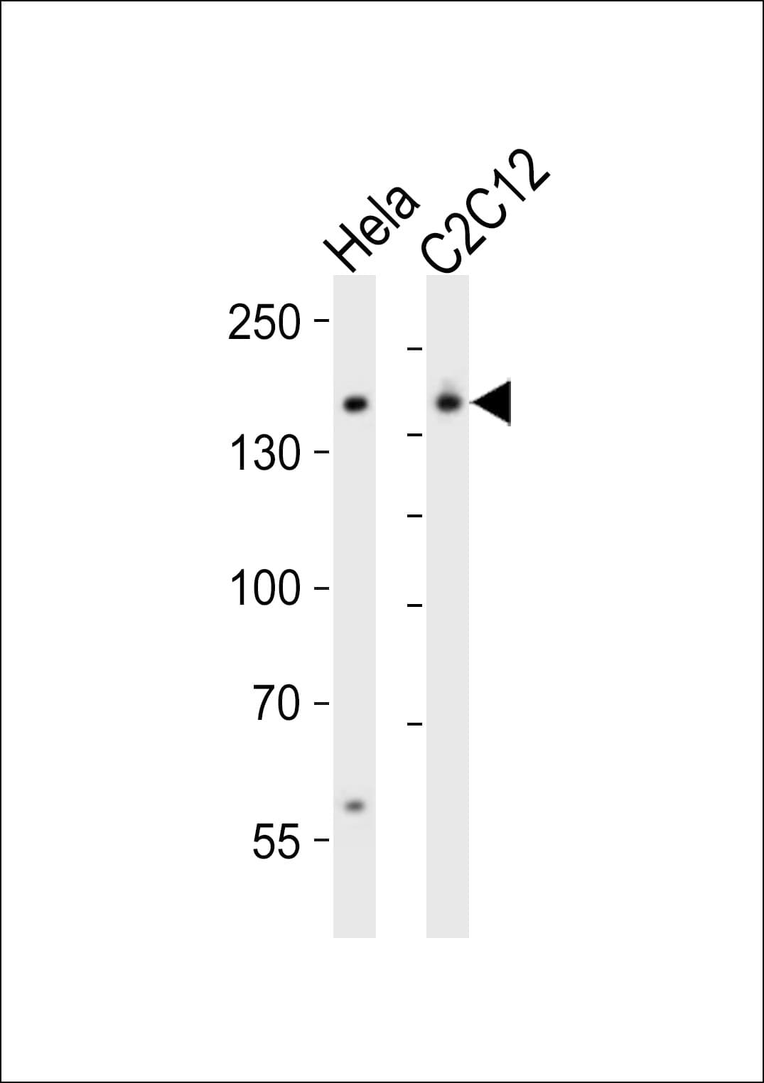 SMARCC1 / SWI3 Antibody (aa963-997)