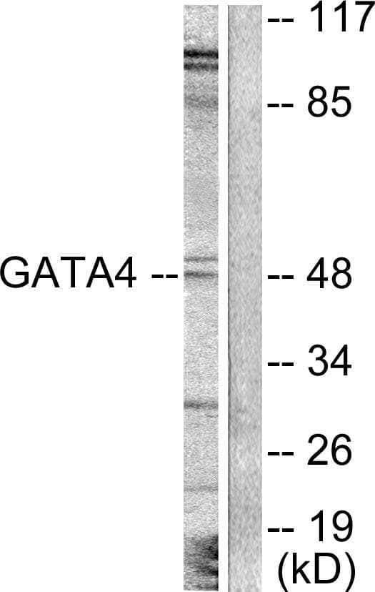 GATA4 Antibody (p262)