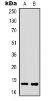 FAT10 / UBD Antibody (Internal)