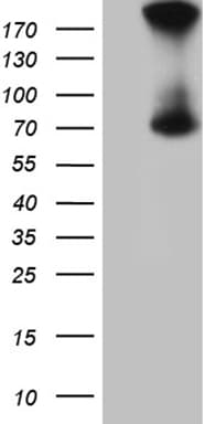 Monoclonal Mouse anti-Human ACS5 / ACSL5 Antibody (clone OTI6B5, aa104-620, WB)