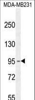 Polyclonal Rabbit anti-Human KCNT2 / KCa4.2 Antibody (aa1069-1097, IHC, WB)