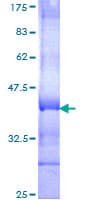 Human SEMA4C / Semaphorin 4C Protein (Recombinant GST, N-terminus)