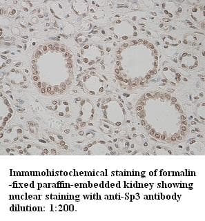 Polyclonal Rabbit anti-Human SP3 Antibody (Internal, IHC)