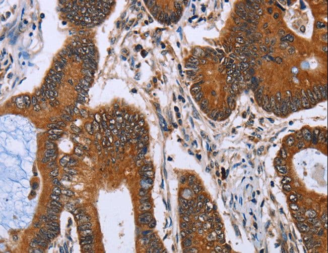 IHH Antibody