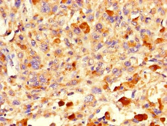 ICT1 / DS1 Antibody