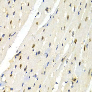 Polyclonal Rabbit anti-Human PTEN Antibody (IHC, WB)