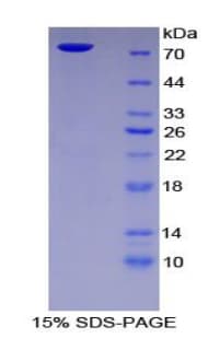 Human ICAM-1 / CD54 Protein (Recombinant GST)
