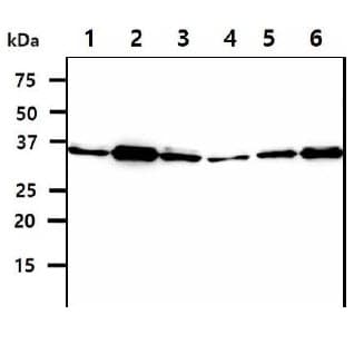 IHC-plus™ Monoclonal Mouse anti-Human SGTA / SGT Antibody (clone AT19E8, IHC, IF, WB)