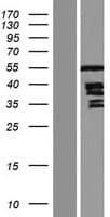 TP / Thymidine Phosphorylase Protein (Over-Expression Lysate Myc-DDK (Flag))
