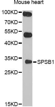 Polyclonal Rabbit anti-Human SPSB1 Antibody (WB)